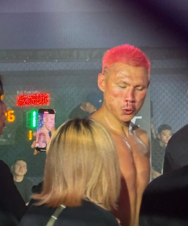 🤯骨裂 了?恶鼠被威姆斯一拳打到面门!鼻梁已经出现严重歪斜! 🤯骨裂 了?恶鼠被威姆斯一拳打到面门!鼻梁已经出现严重歪斜!