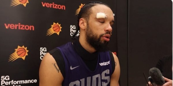 是谁干的？狄龙：练习  中被队友用肘部撞到了额头 我缝了六针